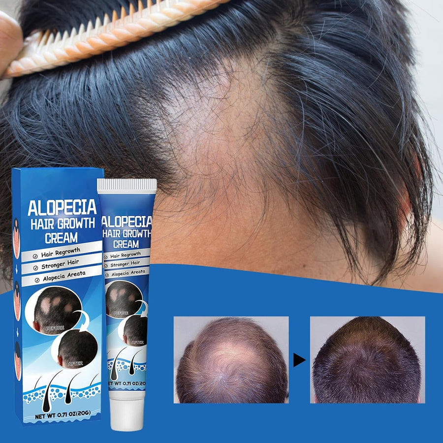 Tratamiento para la alopecia