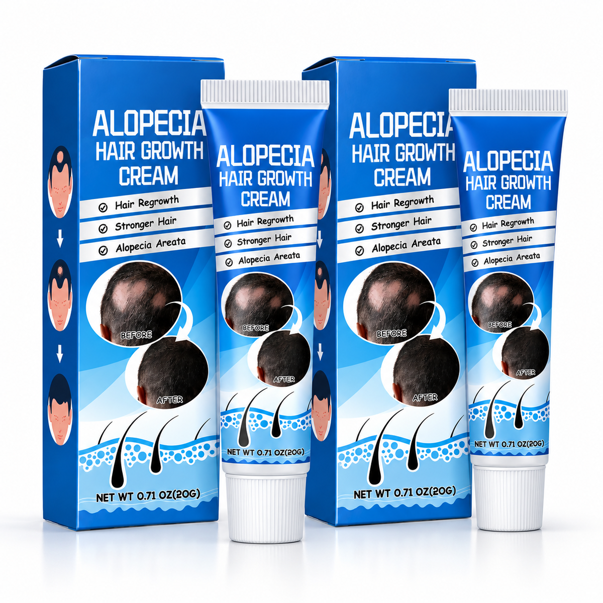 Tratamiento para la alopecia