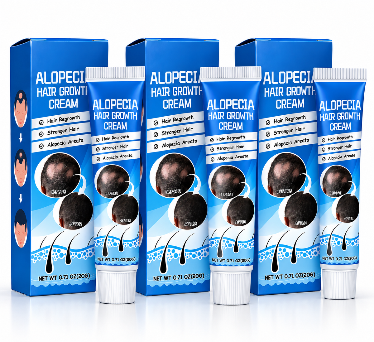 Tratamiento para la alopecia